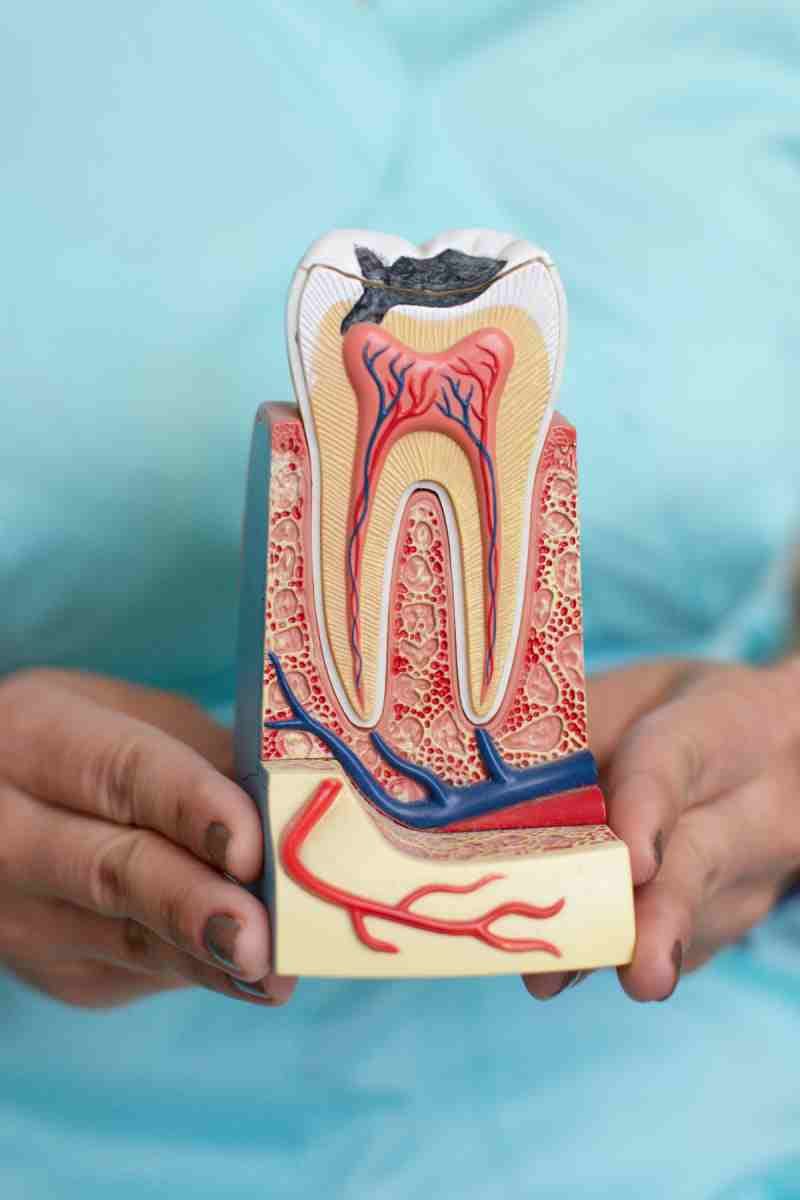 Dentist holding a model tooth with the Tooth root showing